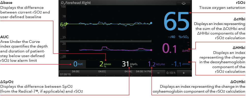 Masimo - O3 Display Cerebral Oximetry